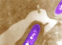 SA: Source of Listeria outbreak identified Listeria outbreak