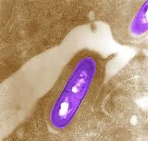 Listeria outbreak